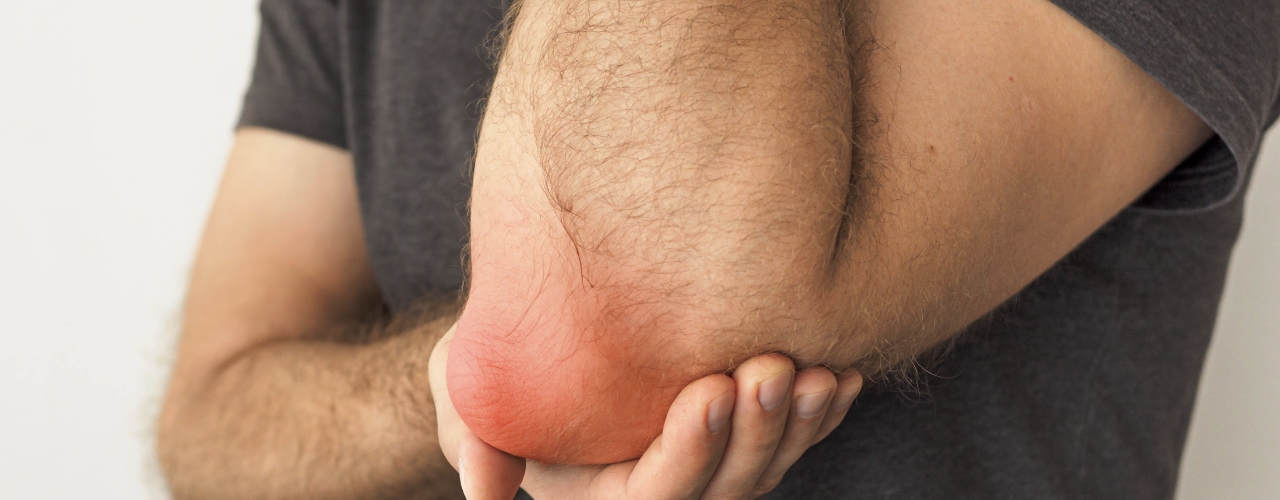 physical-therapy-clinic-bursitis-northstar-pt-star-id